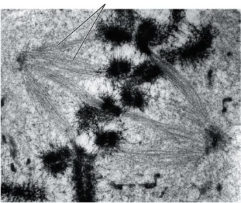 Refer to the diagram below of a phase of mitosis. Which cell structure is indicated by the two leaders?   A)  Chromosome B)  Centromere C)  Chromatid D)  Kinetochore microtubule E)  Centrioles