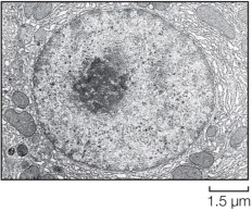 Refer to the figure below showing tubular sacs that surround an organelle, synthesize lipids and steroids, and modify toxic molecules for removal.   These sacs make up the A)  mitochondrion. B)  endoplasmic reticulum. C)  nucleus. D)  vacuole. E)  cytoskeleton.