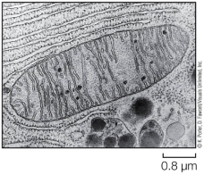 Refer to the figure below.   The organelle shown is found in all cells but is most numerous in cells requiring a large amount of energy (e.g., liver cells) .This organelle is called a(n)  A)  mitochondrion. B)  endoplasmic reticulum. C)  nucleus. D)  vacuole. E)  cytoskeleton.