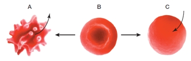Refer to the figure below.   Which statement regarding the red blood cells in the figure is true? A)  Cell C has been immersed in a hypertonic solution. B)  The concentration of solutes inside cell C is higher than in the solution surrounding the cell. C)  Cell A has been immersed in a hypotonic solution. D)  Osmosis occurs when a cell goes from condition B to C but not from condition B to A. E)  Diffusion of solutes out of the cell is causing the events shown in the transition from condition B to A.