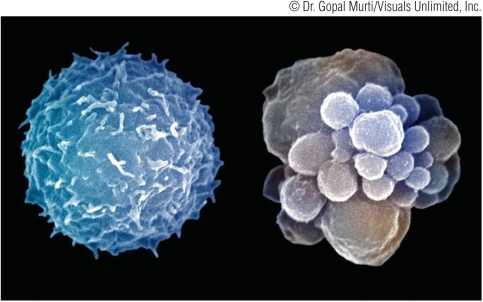 Refer to the figure showing two cells.   The cell on the left is a healthy nondividing cell while the cell on the right is undergoing _______.
