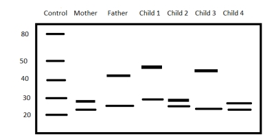 Refer to the figure.   In Huntington's disease (HD)  triplicate repeats of CAG in the huntingtin gene (HTT)  cause a neurodegenerative disease that has a typical age of onset of between 30 and 50 years.A 38-year-old father has been diagnosed with HD.He and his wife are concerned that their four children may develop the disease, so they have the entire family undergo genetic testing.The HTT allele from each family member's DNA sample is amplified using PCR, and the products are then separated using gel electrophoresis.In the figure, the markers on the left side indicate how many triplicate repeats of CAG are in the HTT allele control samples.A person with >40 CAG repeats has a strong possibility of developing HD.When a parent has enough CAG repeats to cause HD, the disease is inherited in an autosomal dominant pattern.According to the results shown, which two of the children have a strong possibility of developing HD? A)  Child 1 and child 2 B)  Child 2 and child 3 C)  Child 3 and child 4 D)  Child 1 and child 3 E)  Child 2 and child 4
