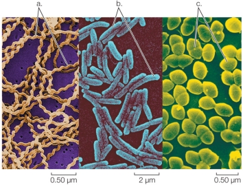 Refer to the figure.   Label the three basic shapes of bacteria shown.