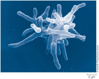 Refer to the figure.   A patient is admitted to the hospital complaining of pain when breathing, fatigue, and night sweats.You collect a cell culture from the patient's lungs and view it under the microscope.Based on the microscope image shown, what conclusions can you draw about the causal agent of the disease your patient is suffering from?