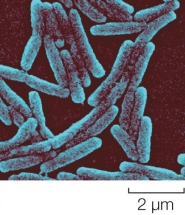 Refer to the figure.   Judging only from the morphology of the cells, which bacterial genus could this micrograph be showing? A)  Enterococcus B)  Staphylococcus C)  Bacillus D)  Leptospira E)  Actinomyces
