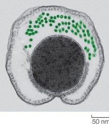 Refer to the figure.   This cross section of a bacterium shows the axial filaments used to produce a corkscrew-like movement.This feature is characteristic of the group of bacteria known as A)  high-GC Gram-positive bacteria (actinobacteria) .  B)  low-GC Gram-positive bacteria (firmicutes) . C)  spirochetes. D)  proteobacteria.  E) cyanobacteria. 