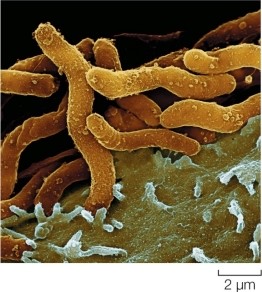 Refer to the figure.   In the 1990s, stomach ulcers were shown by Koch's postulates to be caused by the bacterium Helicobacter pylori.Which of the following is not one of Koch's postulates used to identify pathogens?  A) It must be possible to grow a pure culture of the isolated microorganism. B) Cultured samples must be able to produce disease symptoms in a newly infected host. C) Isolated microorganisms must respond positively to Gram-staining procedures. D) Newly infected hosts must yield the same suspect microorganism in pure culture. E) The suspected microorganism must always be found in diseased hosts. 