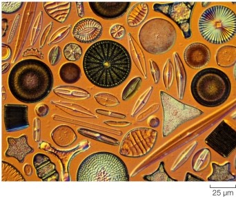 Refer to the figure.   What are the organisms shown in the figure? A)  Diatoms B)  Radiolarians C)  Euglenids D)  Foraminiferans E)  Apicomplexans
