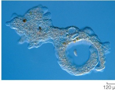 Refer to the figure.   What type of organism is shown? Justify the reasoning behind your conclusion.