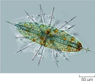 Refer to the figure.   Why are thin, stiff pseudopods so useful to the radiolarian below? A)  They increase the surface area of the radiolarian, allowing for phagocytosis of food particles. B)  They allow the radiolarian to float, giving its photosynthetic endosymbionts maximal access to light. C)  They are used to spear prey and immobilize them for saprobic absorption. D)  They play a role in locomotion, allowing the radiolarian to migrate toward nutrient-rich deposits. E)  They help defend the radiolarian from attacks by other protists.