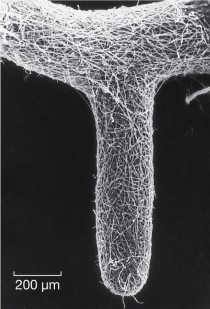 Refer to the figure.   The figure shows A)  haustoria branching from a hypha. B)  a chytrid gametangium. C)  an arbuscular mycorrhizal association. D)  an ectomycorrhizal fungal association. E)  a lichen.