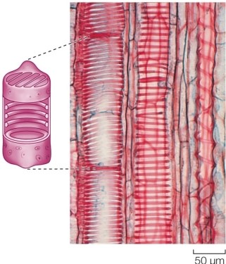 Refer to the figure.   In the figure, the large, dead, hollow, elongated cells are _______, part of the vascular tissue system.