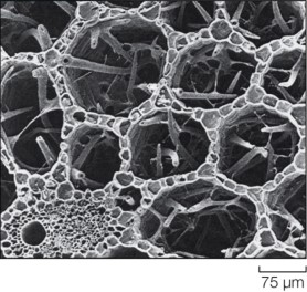Refer to the figure.   A plant with the type of stem structure shown in the image would most likely thrive in a(n)  _______ habitat. A)  tundra B)  aquatic C)  wet terrestrial D)  grassland E)  dry/desert