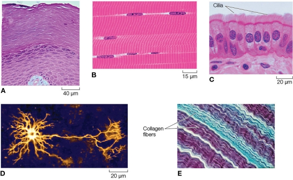 Refer to the figure.   Which part of the figure shows the tissue most likely to be found lining ducts or tubules with a transport function? A)  A B)  B C)  C D)  D E)  E