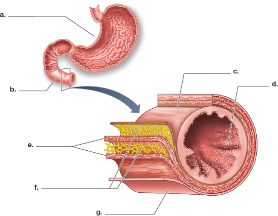 Refer to the figure.   Use the following terms to label the organs and four main tissue types in the figure: connective tissue, epithelial cells, mucosa, nervous tissue, small intestine, smooth muscle, stomach.(Note: Terms may be used more than once.)