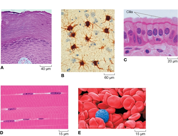 Refer to the figure.   Two tissues you would find in your brain are shown in _______.