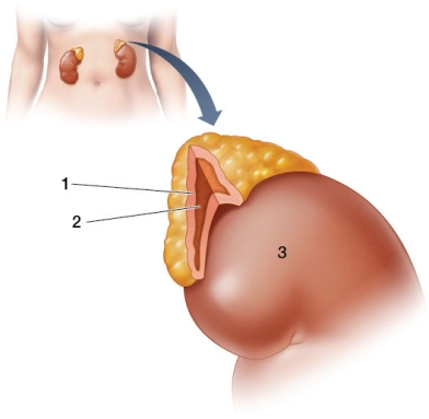 Refer to the figure showing the adrenal gland.   Based on the figure, which structure(s)  is/are most directly involved in raising your blood pressure in response to stress? A)  Structure 1 only B)  Structure 2 only C)  Structure 3 only D)  Structures 1 and 2 E)  Structures 2 and 3
