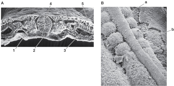 Refer to the figure showing two scanning electron micrographs of a chick embryo.Part A of the figure shows the embryo in cross section, and part B shows the embryo as you look down from above, with the overlying epidermal ectoderm removed.   In comparing these images, we can see that the structures labeled  a  and  b  in part B correspond to the structures labeled _______ in part A, respectively.