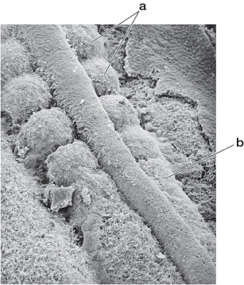 Refer to the figure showing a scanning electron micrograph of a chick embryo.   In this image the overlying epidermal ectoderm has been removed, and we are looking down on the embryo from above.The tissue labeled  a  will soon form a(n) _______, which lies posterior to the structures labeled  b. 