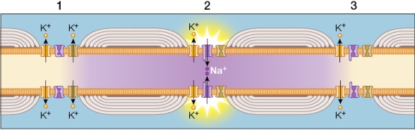 Refer to the figure showing the conduction of an action potential traveling from left to right in a myelinated axon.Note the action potential at node 2.   Which statement about section 2 of the axon is true? A)  Depolarization is caused here by the opening of voltage-gated K<sup>+</sup> channels. B)  The speed of the action potential in this axon depends mostly on its diameter. C)  Na<sup>+</sup> channels remain open here until the action potential has reached the axon terminal. D)  A loss of signal will occur as the action potential travels to each adjacent node. E)  Na<sup>+</sup> channels will inactivate at this node and enter a refractory state.