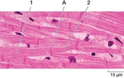 Refer to the figure showing muscle cells.   In the living tissue, if an action potential stimulates contraction of cell 1, will cell 2 also contract? A)  Yes, because an action potential in cell 1 will spread to cell 2 through gap junctions in structure A. B)  Yes, because the motor neuron A that innervates cell 1 also innervates cell 2. C)  No, because the action potential will be stopped by structure A, which separates cell 1 and cell 2. D)  Yes, because the smooth muscle cell labeled 1 will spread the action potential to cell 2 through the neuromuscular junction at A. E)  No, because the skeletal muscle cell labeled 1 is not physically connected to cell 2 through gap junctions.