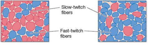 Refer to the figure showing the leg muscles of two athletes.   Investigators studying the leg muscles of Usain Bolt, the Olympian recognized as the fastest sprinter in the world for his performance in the 100-meter dash, would likely find _______ muscle fibers, as shown in the panel on the _______. A)  abundant slow-twitch; left B)  hyper-efficient slow-twitch; left C)  atrophied (neglected)  slow-twitch; left D)  abundant fast-twitch; right E)  atrophied (neglected)  fast-twitch; right