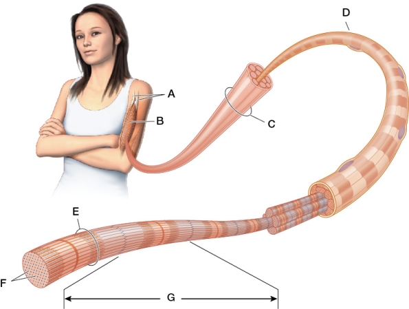 Refer to the figure showing the structure of a skeletal muscle.   When the woman in the figure extends her arms so they are hanging down at her sides, which structures will lengthen, which will shorten, and which will stay the same?
