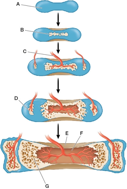 Refer to the figure showing the growth of a long bone.   How does the type of bone at E differ from that shown at G in terms of weight, and what structural differences are responsible this weight difference?