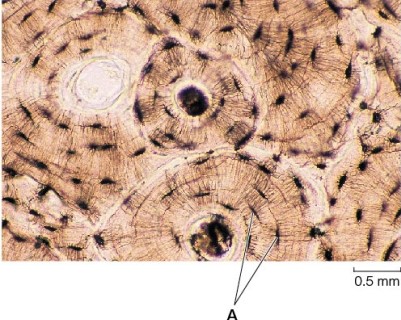Refer to the figure showing a micrograph of bone.   In this section of compact bone, the cells located at A are called _______, and they _______. A)  osteocytes; communicate with other bone cells through cellular extensions that run through tiny channels B)  osteocytes; break down bone matrix C)  osteoblasts; communicate with other bone cells through cellular extensions that run through tiny channels D)  osteoclasts; communicate with other bone cells through cellular extensions that run through tiny channels E)  osteoclasts; break down bone matrix