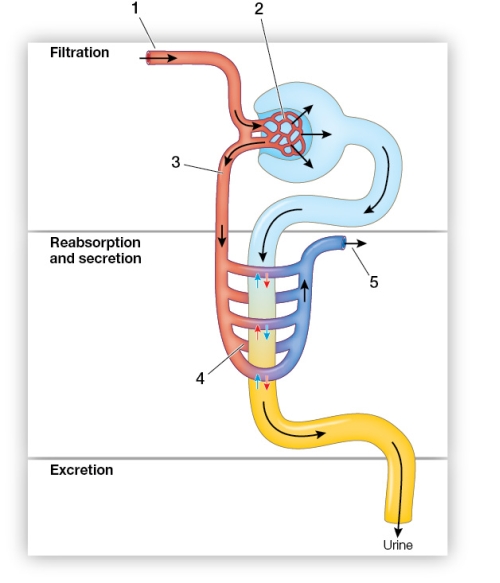 Refer to the figure showing the vertebrate nephron.   Based on the figure, which statement is false? A)  Structure 1 is an efferent arteriole. B)  Structure 2 is the glomerulus, where blood is filtered. C)  Structure 4 brings materials to the tubules that will be secreted into the urine. D)  Structure 4 carries reabsorbed materials away from the tubules. E)  Structure 5 is a renal venule.