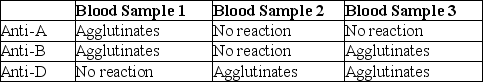 Three blood samples are exposed to the antiserums shown below with the given reactions.Based on these results,determine the ABO/Rh blood type of each sample.   