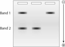 Given the following gel,whichDNAfragment has a lower molecular mass?   