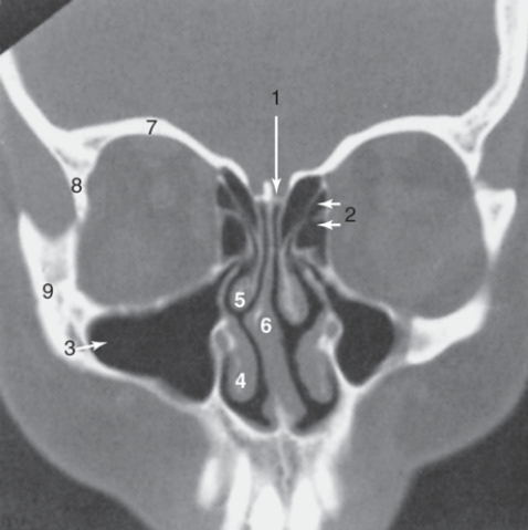 Asnwer the Questions according to the figure below:  -The zygoma is labeled:   A) 6 B) 7 C) 8 D) 9
