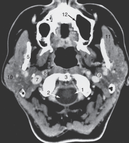 Use the following figure to answer the questions:  -The parotid gland is labeled:   A) 8 B) 9 C) 10 D) 11