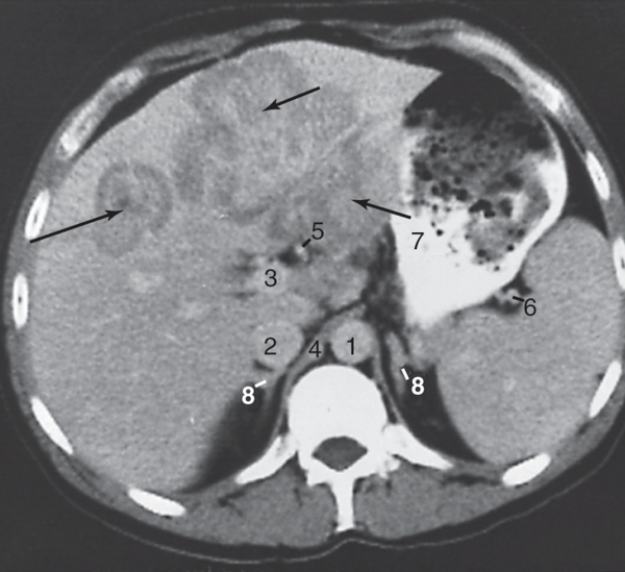 The adrenal glands are labeled:   A) 3 B) 4 C) 5 D) 8