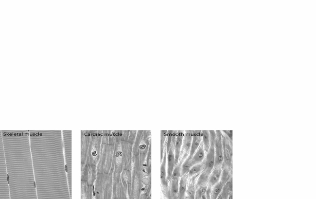 MATCHING: ART     The following questions relate to accompanying figure of the three types of muscle tissue. Use the figure to help match the following characteristics with the correct muscle type. -Involuntary A) Skeletal muscle only B) Cardiac muscle only C) Smooth muscle only D) Skeletal and Cardiac muscle E) Cardiac and Smooth muscle F) All three muscle types