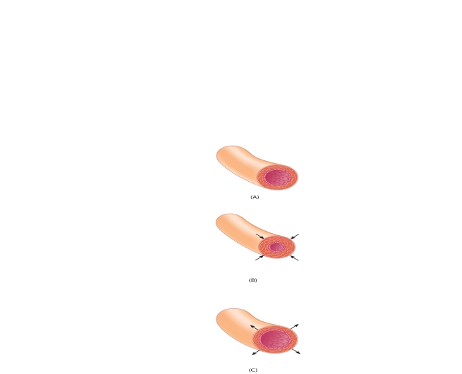    The following questions refer to the accompanying diagram of arteriole vasoconstriction and vasodilation. The diagram shows three state of arteriole tone. The top image labeled  A,  shows normal tone. The other two panels labeled  B  and  C  show different state of arteriole tone. Match the statements below with the correct arteriole using A, B, and C. -Caused by sympathetic stimulation