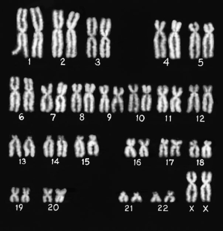 <strong>What is the gender of the person indicated in the photograph? </strong> A) Male B) Female C) Cannot be determined
