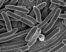 What kind of prokaryotes are these?   A) bacilli B) spirochetes C) cocci D) ciliates