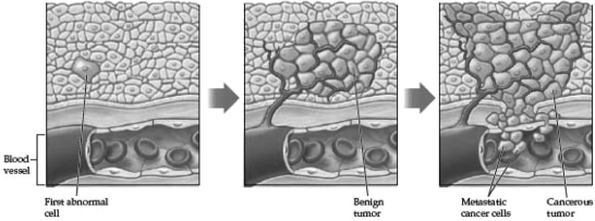 Examine the following diagram.Which is most likely to have occurred in panel 2,depicting tumor formation?   A)  loss of adhesion dependence B)  initiation of angiogenesis C)  mutation of a proto-oncogene into an oncogene D)  metastasis