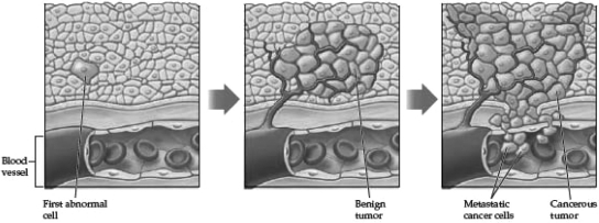 Examine the following diagram.Which is most likely to have occurred in panel 1,depicting proliferation?   A)  loss of adhesion dependence B)  initiation of angiogenesis C)  mutation of a proto-oncogene into an oncogene D)  metastasis