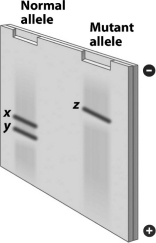 The DNA for the normal hemoglobin allele and the mutant sickle-cell allele are cut with the same restriction enzyme,DdeI.The resulting DNA fragments are separated by gel electrophoresis,producing the gel shown in the following figure.Why are the patterns produced by these two alleles different?   A)  The normal hemoglobin gene is cut by two restriction enzymes, but the sickle-cell anemia allele is cut by only one restriction enzyme. B)  The gene for the normal allele is much larger than the gene for sickle-cell anemia. C)  The gene for the normal allele has a sequence recognized by DdeI, but the gene for sickle-cell anemia does not. D)  The sickle-cell allele has the ability to produce ligase to repair the damage done by restriction enzymes, but the normal allele does not.