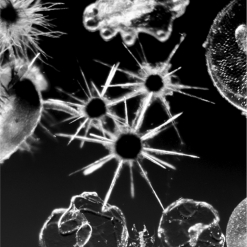 What adaptive advantage do the numerous projections shown in the following microphotograph of the foraminiferans,a type of zooplankton confer?   A)  predator protection-they are difficult to eat B)  mobility-the projections function like oars C)  buoyancy-the projections reduce the rate of sinking D)  food acquisition-prey items are impaled