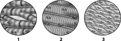 Analyze the tissue images below and select which statement is true.   A)  Tissue 1 can be found lining the digestive tract. B)  Tissue 1 is used to line the endocrine system. C)  Tissue 2 is found attached to bones. D)  Tissue 3 is used to conduct nerve impulses.