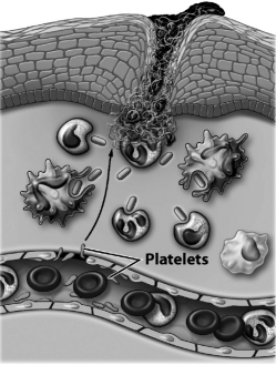 The image below depicts   A)  adaptive immunity: antibodies are being made. B)  passive immunity: neutrophils are being destroyed. C)  innate immunity: memory cells are being made. D)  inflammatory response: blood vessels are porous and leaking fluid.