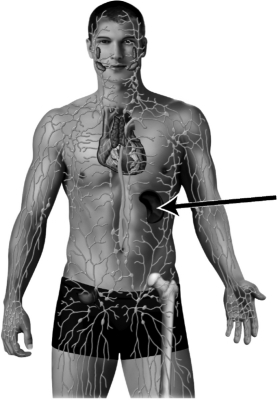 In the illustration below of the lymphatic system,the arrow is pointing to a kidney.   
