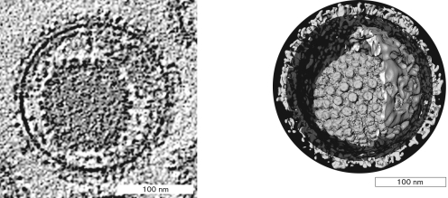 Identify the outer structure shown in the figure below. What is it composed of and how does it differ from the bacterial version?   