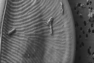 An association between two Antarctic microorganisms is pictured below. It provides an interaction that supplies ________, made by the ________, to the ________.   A)  amino acids; diatom; bacterium B)  fixed nitrogen; diatom; bacterium C)  fixed nitrogen; bacterium; diatom D)  vitamin B12; diatom; bacterium E)  vitamin B12; bacterium; diatom