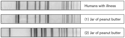 Use the figure below to discuss how molecular tools are used in the investigation of pathogen-contaminated food. What does the figure represent? What is the overall conclusion of the analysis?   
