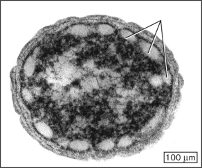 Which feature, indicated in the following figure, do Chlorobi share with Chloroflexi and Chloracidobacterium thermophilum?   A)  chlorosomes B)  thylakoids C)  halophily D)  endospores E)  hormogonia